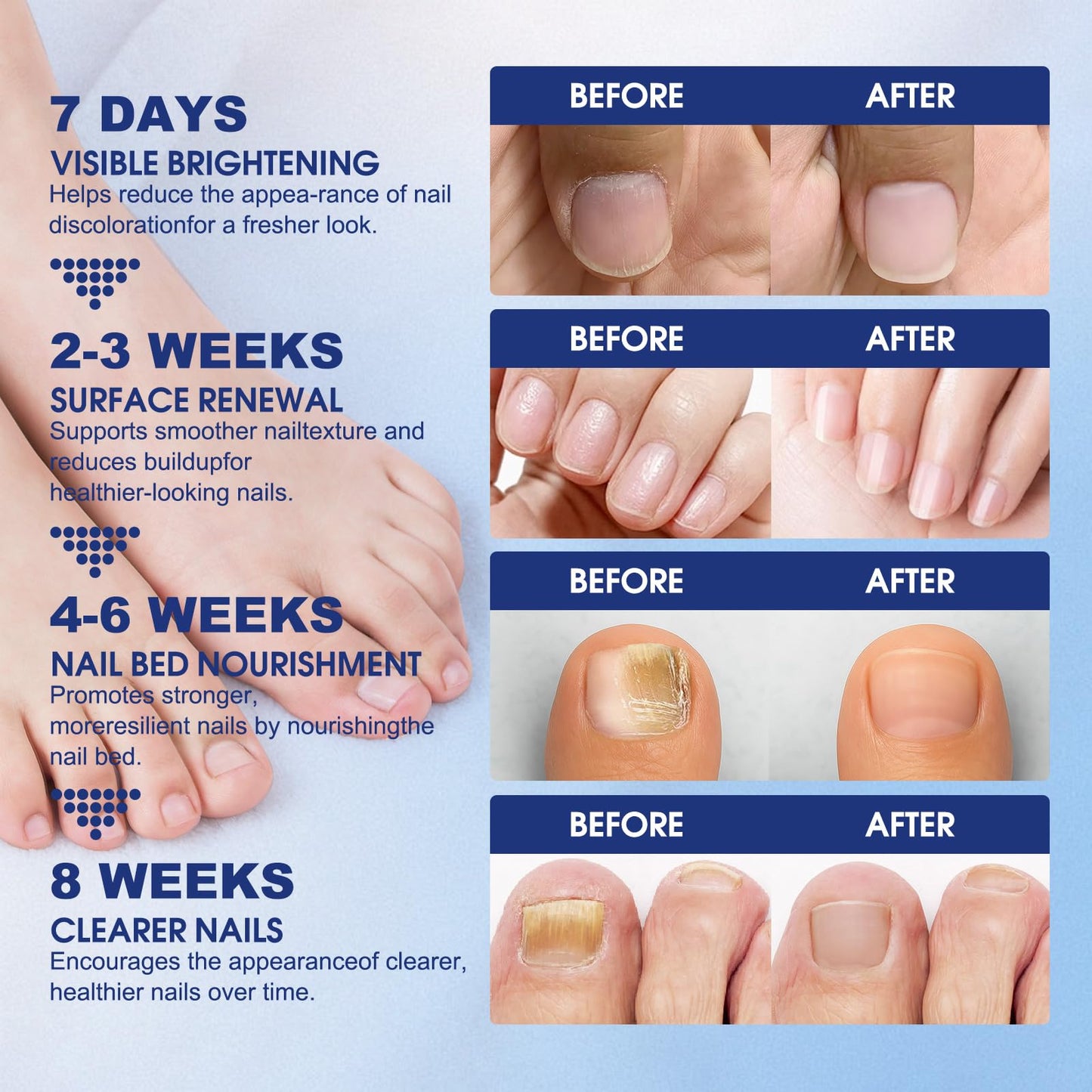 Toenail Fungus Treatment Extra Strength - 21 Pcs Fungal Nail Patches, nail repair patches-8-Hour Firm Adhesion, Nail Repair patches for Damaged Nails, Overnight Renewal for Men and Women