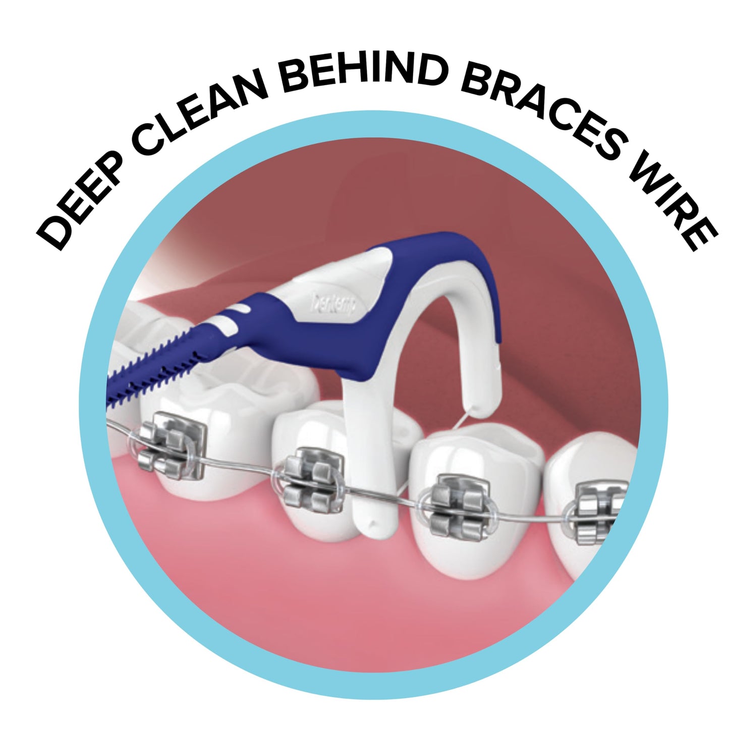 Dentemp Braces Flosser - Designed for Braces for an Easy & Effective Clean, Ultra Strong Floss - 40 Count (Pack of 4) - (Packaging May Vary)