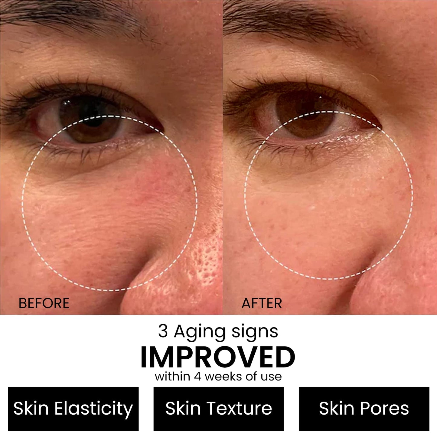 Kleem Retinol Serum 2.5% for Face Anti-Aging Serum with Hyaluronic Acid to Minimize Wrinkles. Improves Sun Damaged Skin and Fades Dark Spots - Vitamin A Serum - Dermatologist Tested (1oz)