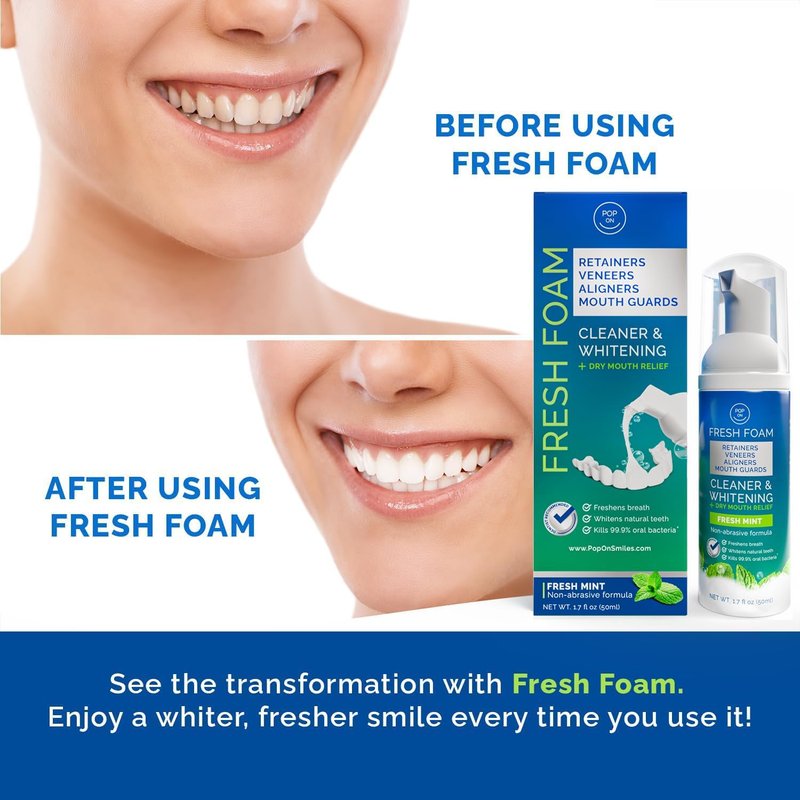 Aligner & Retainer Cleaner Foam – Dry Mouth Relief, Compatible with Invisalign, Aligners, Retainers, Mouth Guards, Night Guards, Veneers, Whitens, Freshens, 3% Hydrogen Peroxide, Mint - 50ml, 2 PC