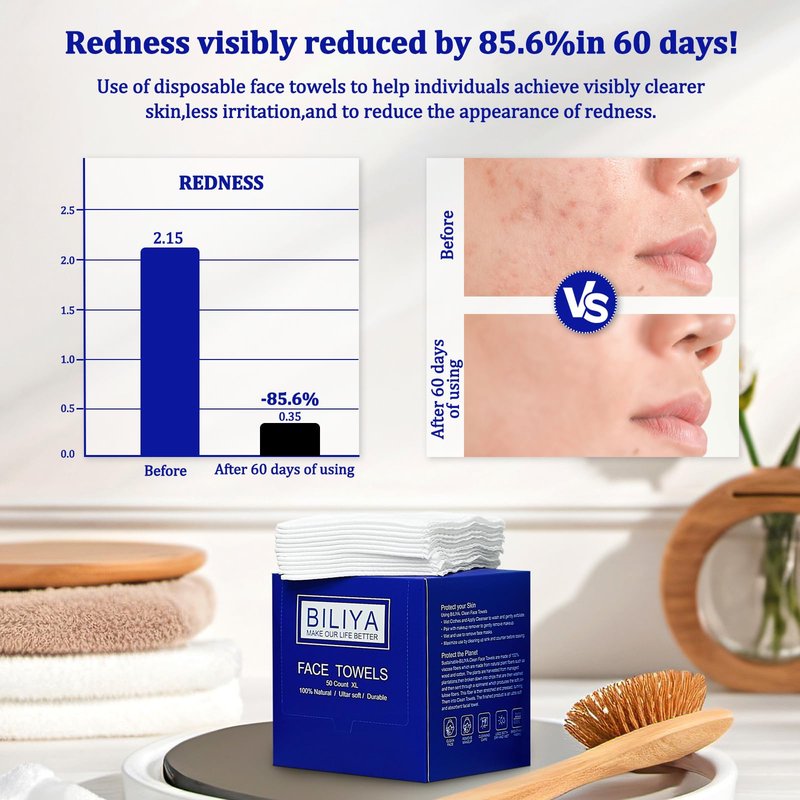 Disposable face towel XL,face cleaning wipes,makeup wipes,towels,Ultra Soft 10 x 12 inches 100 ct, 2 pack