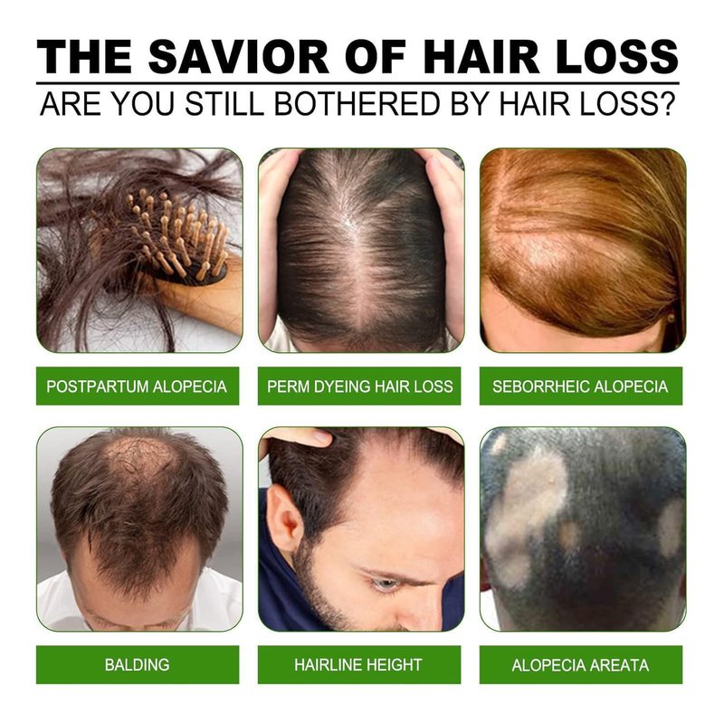 Hair Regrowth System - Nourishing Biotin Serum for Thicker Hair Growth | 2 oz + 6 oz