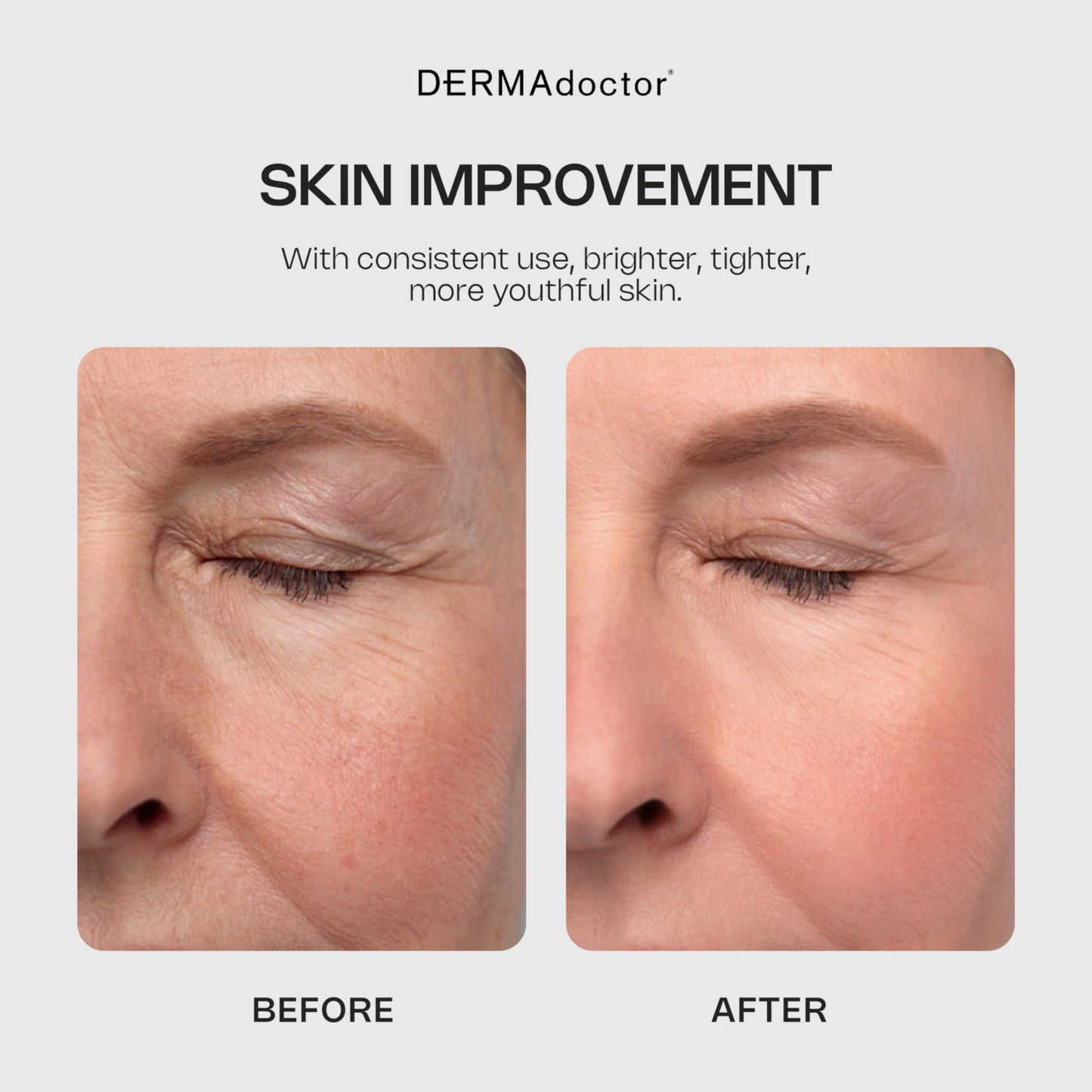 DERMAdoctor Glycolic Acid Face Wash – Exfoliating Face Wash with Antioxidants, Dermatologist Formulated Anti-Aging Facial Cleanser for Fine Lines, Wrinkles, Dullness, Uneven Skin Tone & Enlarged Pores