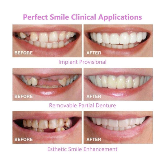 2 Pairs, Temporarily Restore Confident Smiling, Adjustable for Men and Women, Top and Bottom (1)