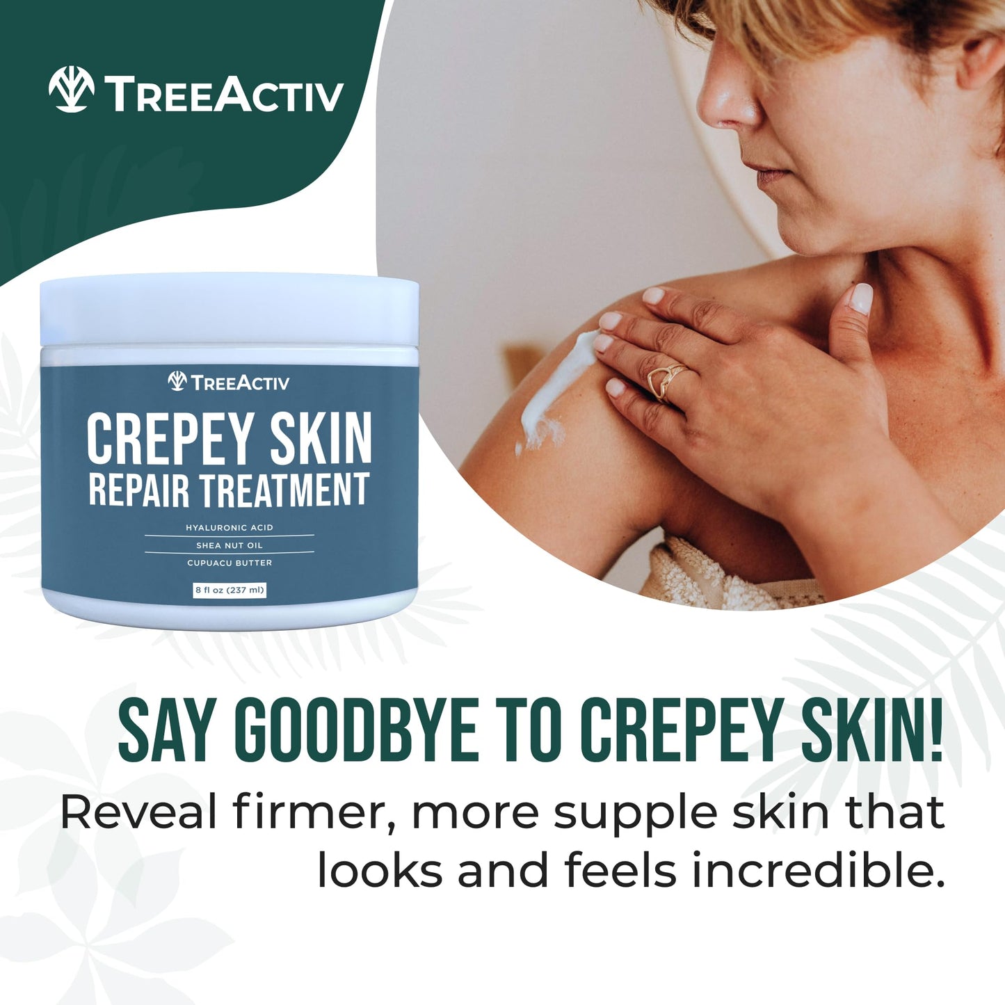 TreeActiv Crepey Skin Repair Cream Original Formula, 8 fl oz, Firming Cream For Face & Neck, Skin Firming Lotion with Hyaluronic Acid, Crepey to Address Dry Crepe