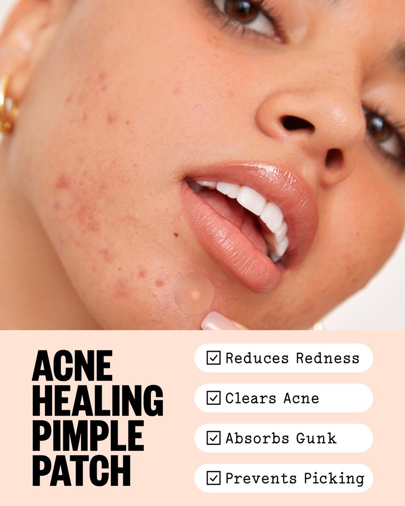 PEACE OUT Acne Healing Dots Hydrocolloid Pimple Patches, Acne Spot Treatment with Salicylic Acid, Retinol, and Aloe Vera for Blemishes and Breakouts (40 count)