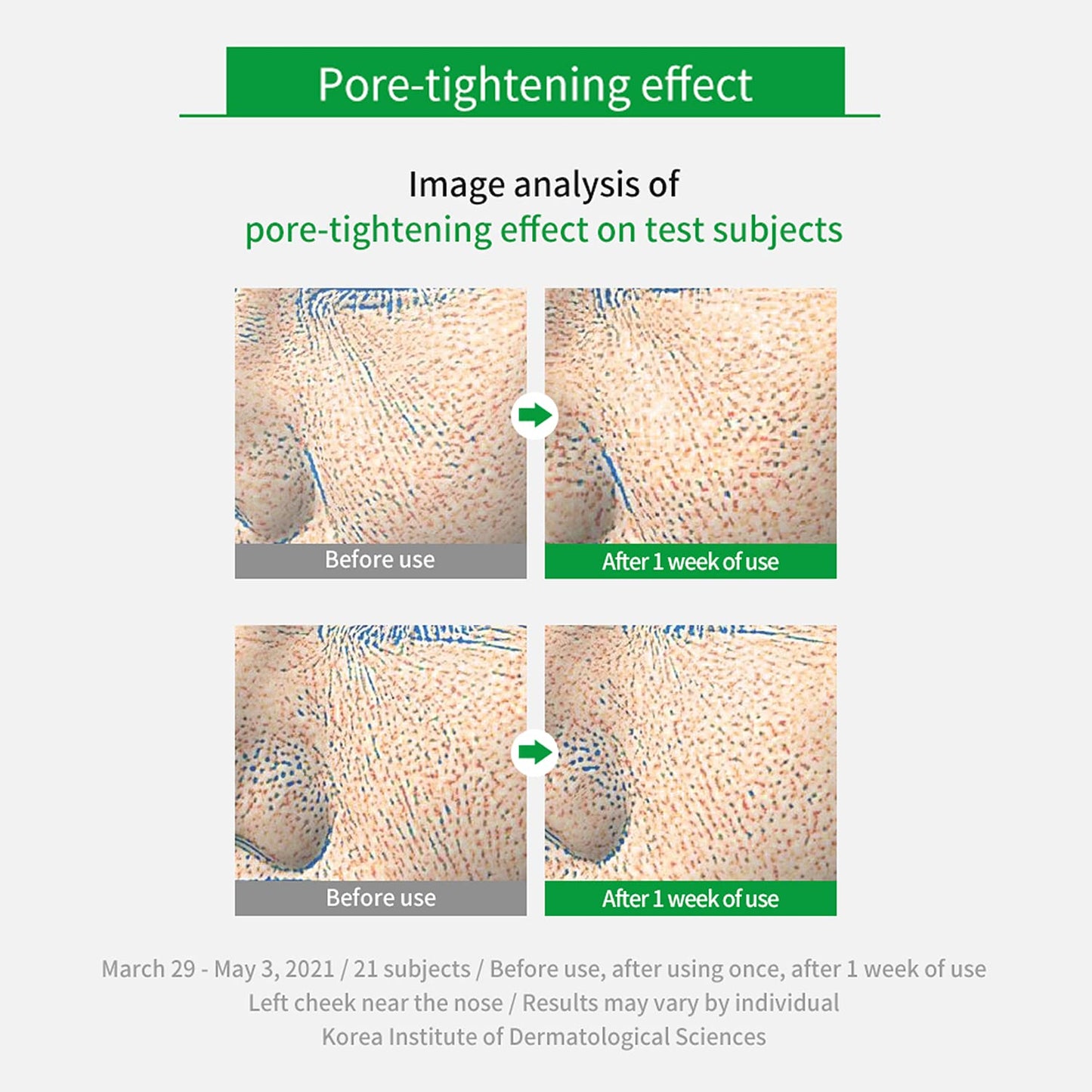 WELLAGE Real Cica Calming Zero Pore Toner Pads 70 Sheets Big Embo, Korean Beauty Facial Pads, Centella Asiatica, PHA, LHA, and Madecassoside, CICA for Soothing, Calming, and Hydrating