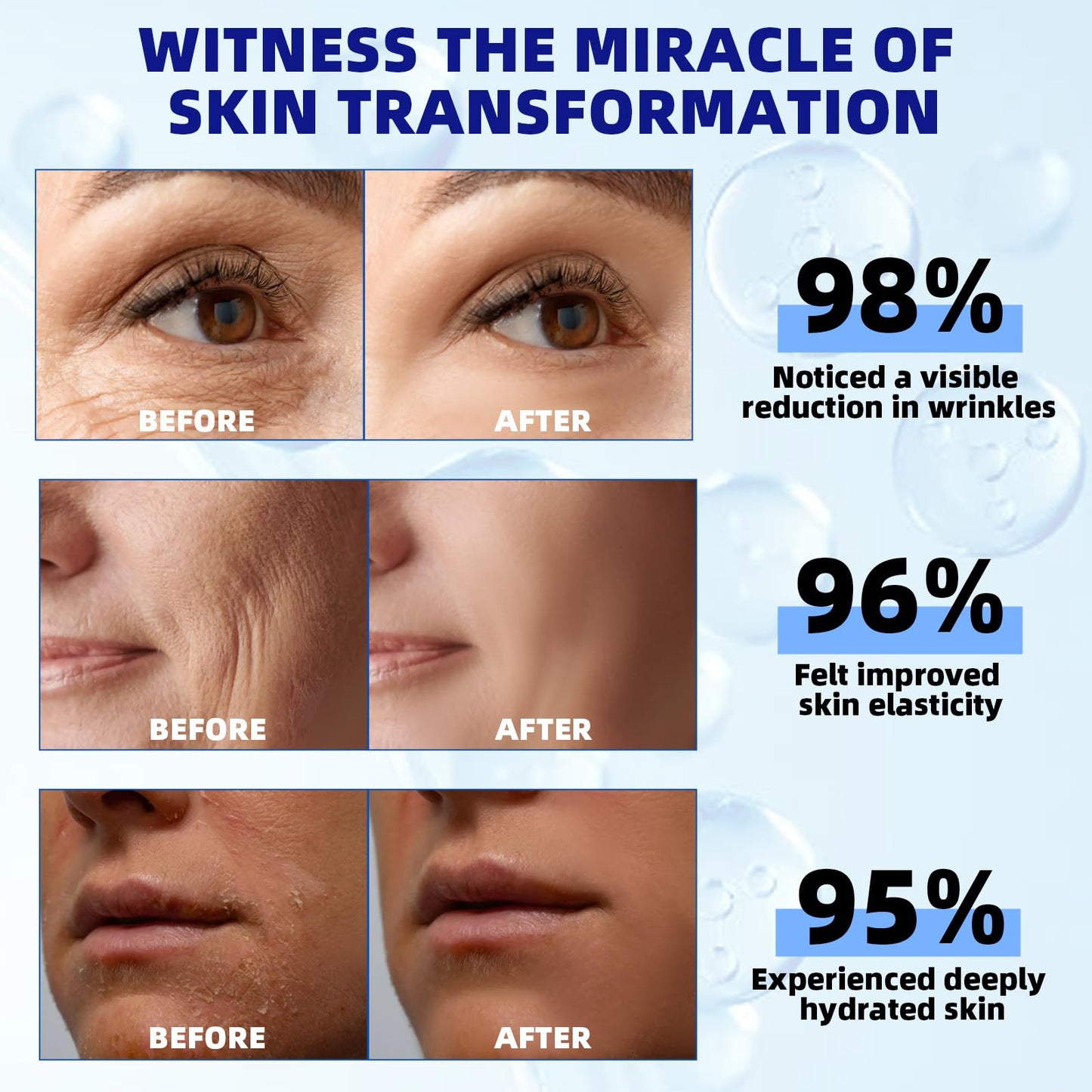 Bioglossy Retinol Serum for Face, 2.5% Retinol Intense Night Serum with Squalane,Vitamin C & E & B3,Hyaluronic Acid for Lines, Wrinkles & Premature Sun Damage to Resurface & Hydrate 30 ml/ 1 Fl oz