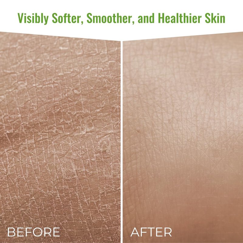 Wild Naturals Moisturizing Eczema Body Wash, Gentle Psoriasis Body Wash for Itchy, Dry Skin Relief Eczema Soap for Redness and Flareups, Hydrating Cleanser for Women and Men