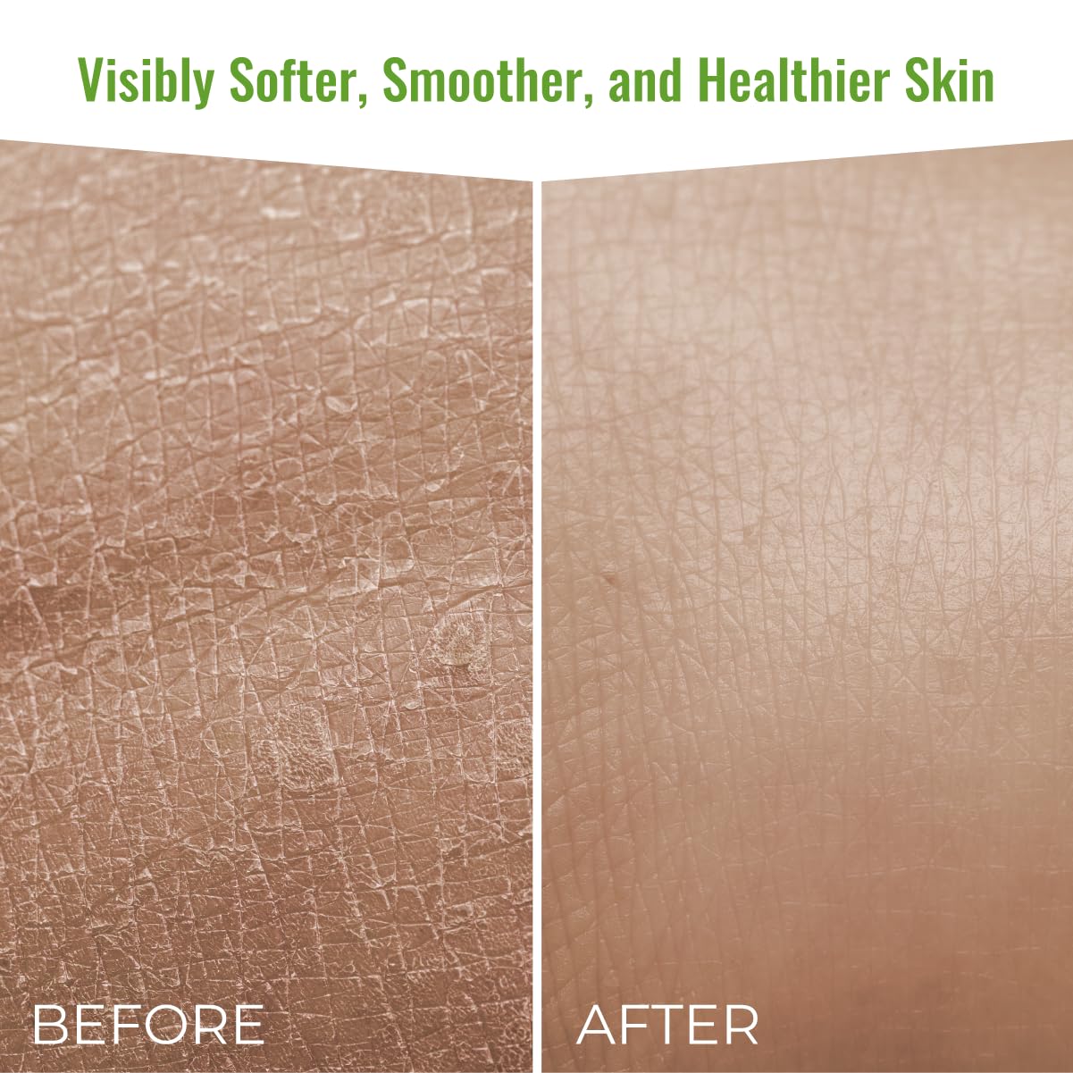 Wild Naturals Moisturizing Eczema Body Wash, Gentle Psoriasis Body Wash for Itchy, Dry Skin Relief Eczema Soap for Redness and Flareups, Hydrating Cleanser for Women and Men