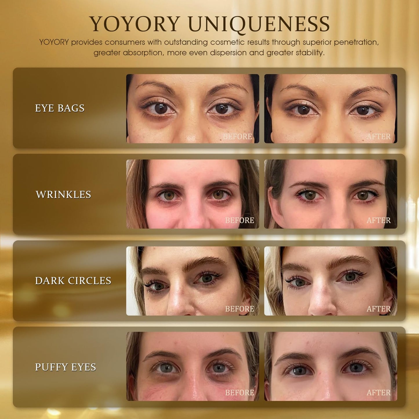 YOYORY Under Eye Patches for Dark Circles & Puffy Eyes-60 Hydrogel Eye Mask Patches with Caffeine, Collagen, Hyaluronic Acid- Anti Wrinkle Smile Line Patches, Self Care Gifts for Women,Rose Gold