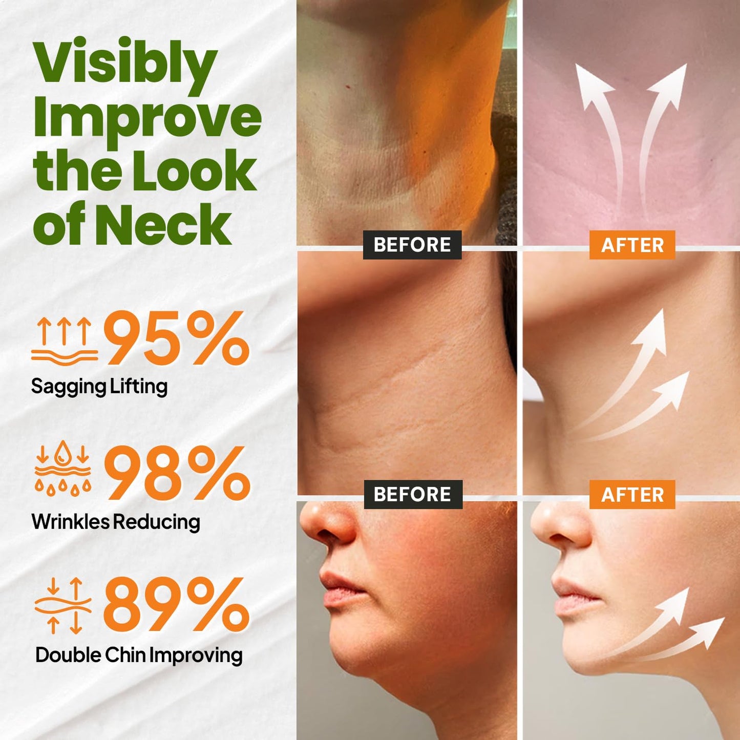 Neck Cream for Tightening Firming: Instant Face Lift Cream - Anti Wrinkle Cream with Retinol Collagen & Hyaluronic Acid - Lifting, Firming & Hydrating for Women- 1.7 FL OZ