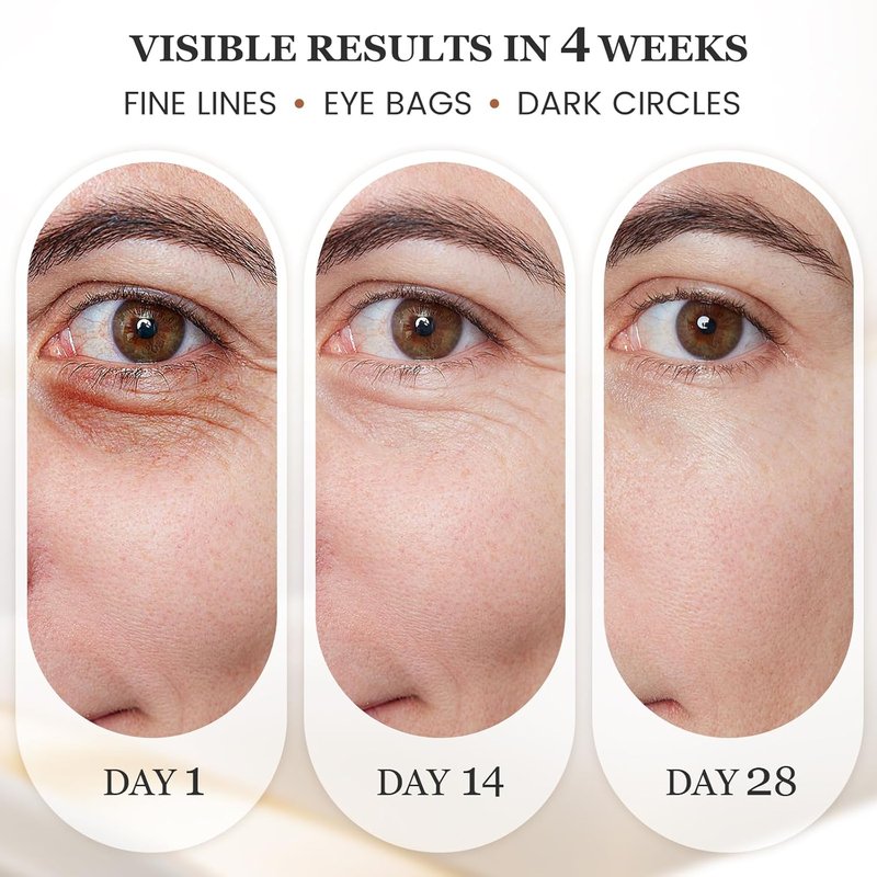 Eye Lift Wand - Temperature Control Eye Massager for Dark Circles & Puffiness | White