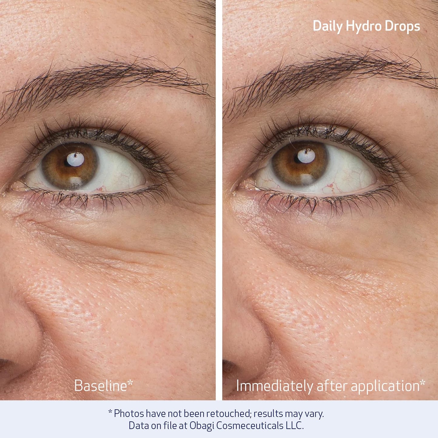 Obagi Daily Hydro-Drops Facial Serum & Rejuvenating Eye Gel Cream Set – 1oz Facial Serum Hydrates & Helps Soften the Appearance of Wrinkles & .5oz Eye Cream Instantly Brightens, Smooths, & Depuffs