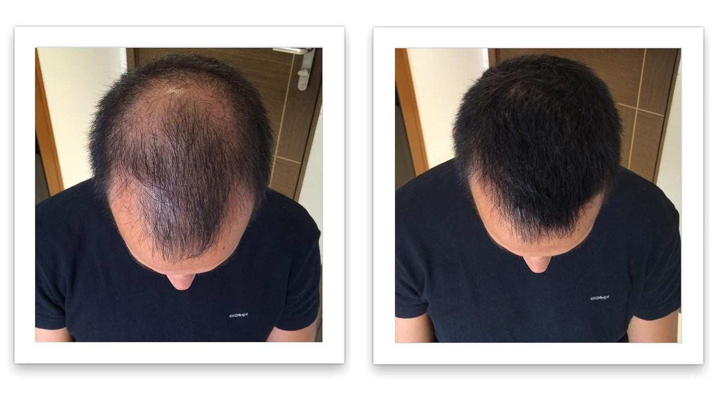 Caboki Hair Fibers - Natural Plant-Based Thinning Hair Solution for Men & Women | 10-Day Trial Size, Black