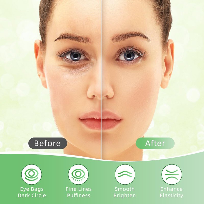 USTELIR Under Eye Patches, 40 Pairs Eye Mask for Dark Circles, Puffy Eyes, Undereye Bags,Wrinkles,Eye Mask Patches with Aloe Vera, Eye Treatment Skin Care for Men & Women Gift