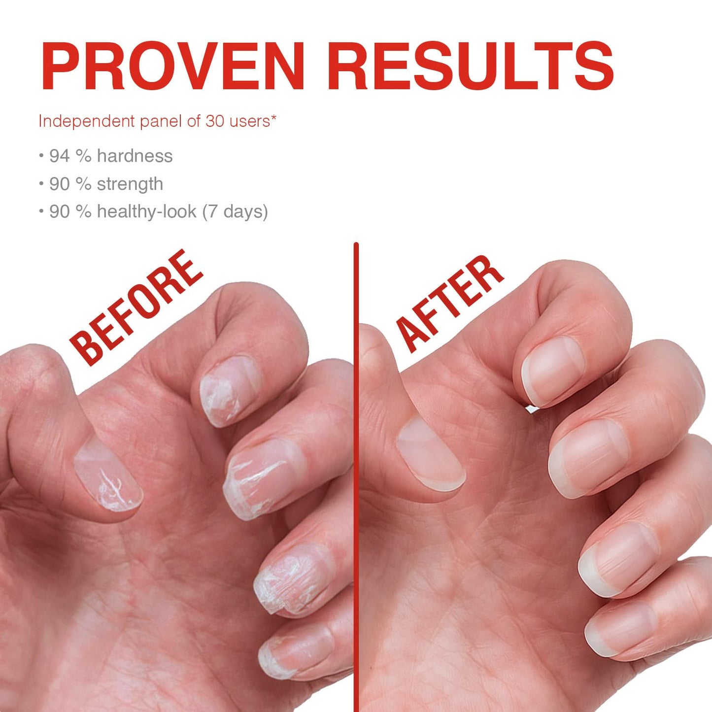Probelle Nail Strengthening Formula, Nail Growth & Conditioning, Stops Splits, Chips, Cracks & Strengthens Nails, Clear
