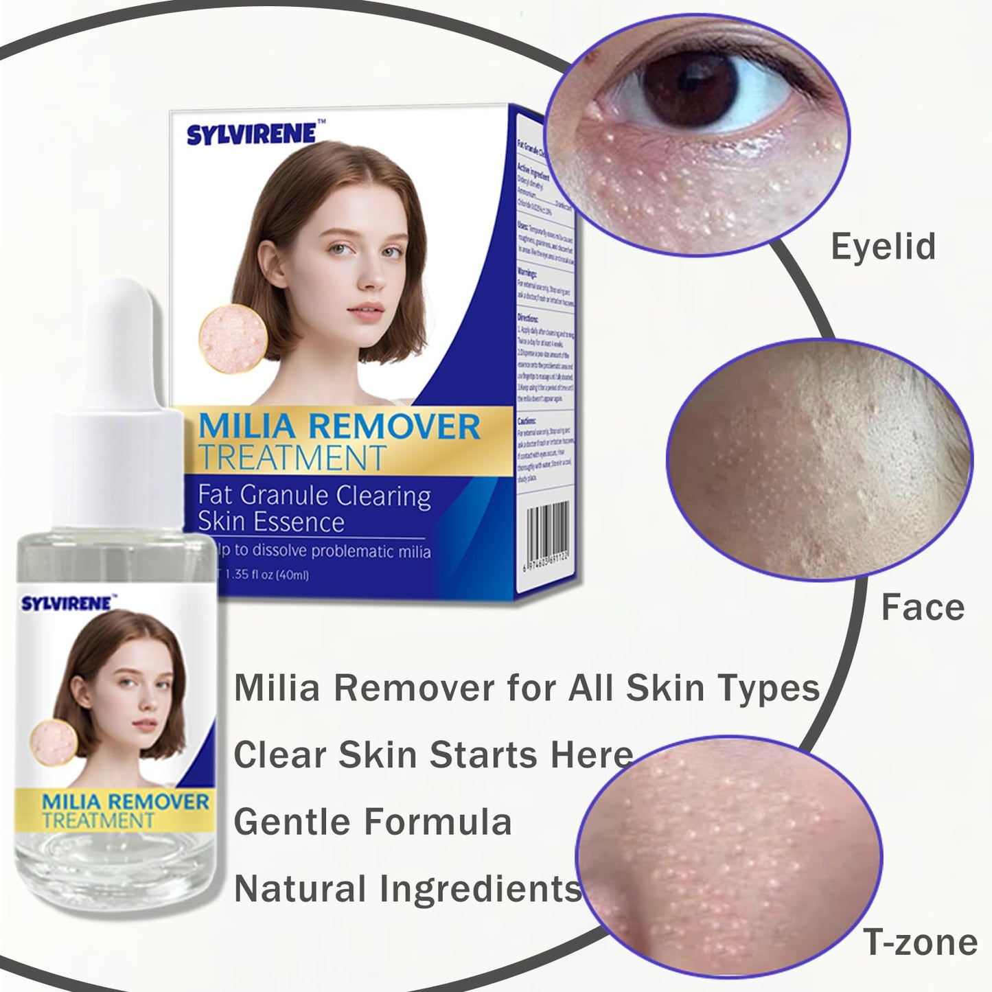 Sylvirene 40 ml Milia Remover Serum for Eyes & Face, Milia Removal Essence, Milia Spot Remover Serum for Clear Skin