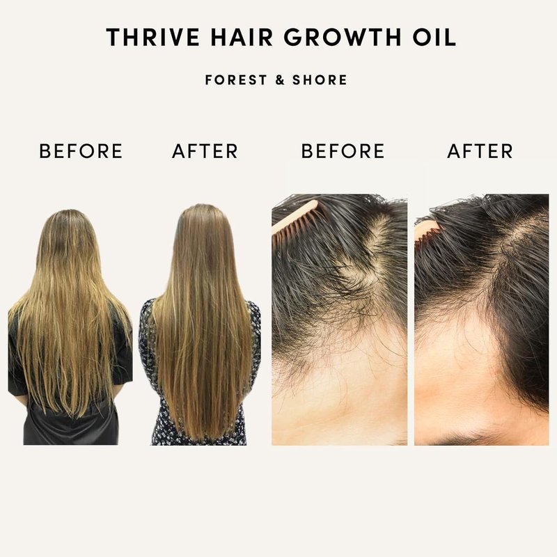 Hair Growth Oil - 100% Natural Caffeine & Biotin Serum for Damaged Hair | Argan, Castor & Rosemary Oils