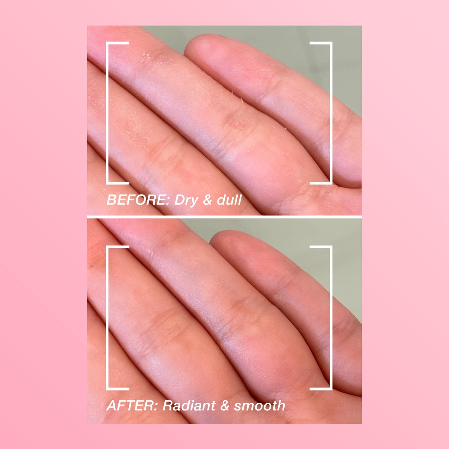 Infinitek Paris | Blossom Hand Cream - Moisturizing Cream for Dry Hands | Galentine’s Gifts & Valentine’s Day Gifts for Women | Anti Aging Hand Cream for Women | 70 g / 2.4 fl oz