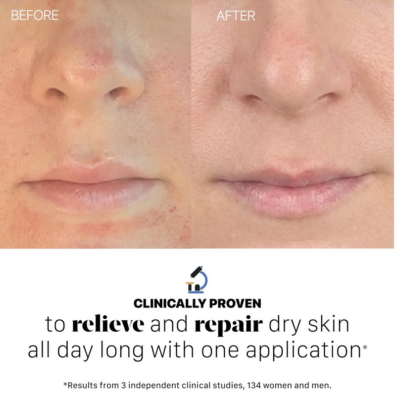 Dr. Arsy Eczema Cream #003 Clinically Tested Ultra-Rich Relief, Repair & Hydrating Moisturizer for Dry Sensitive Face & Body | Hypoallergenic | Steroid-Free, Vegan | Vitamins & Amino Acids | 4 oz