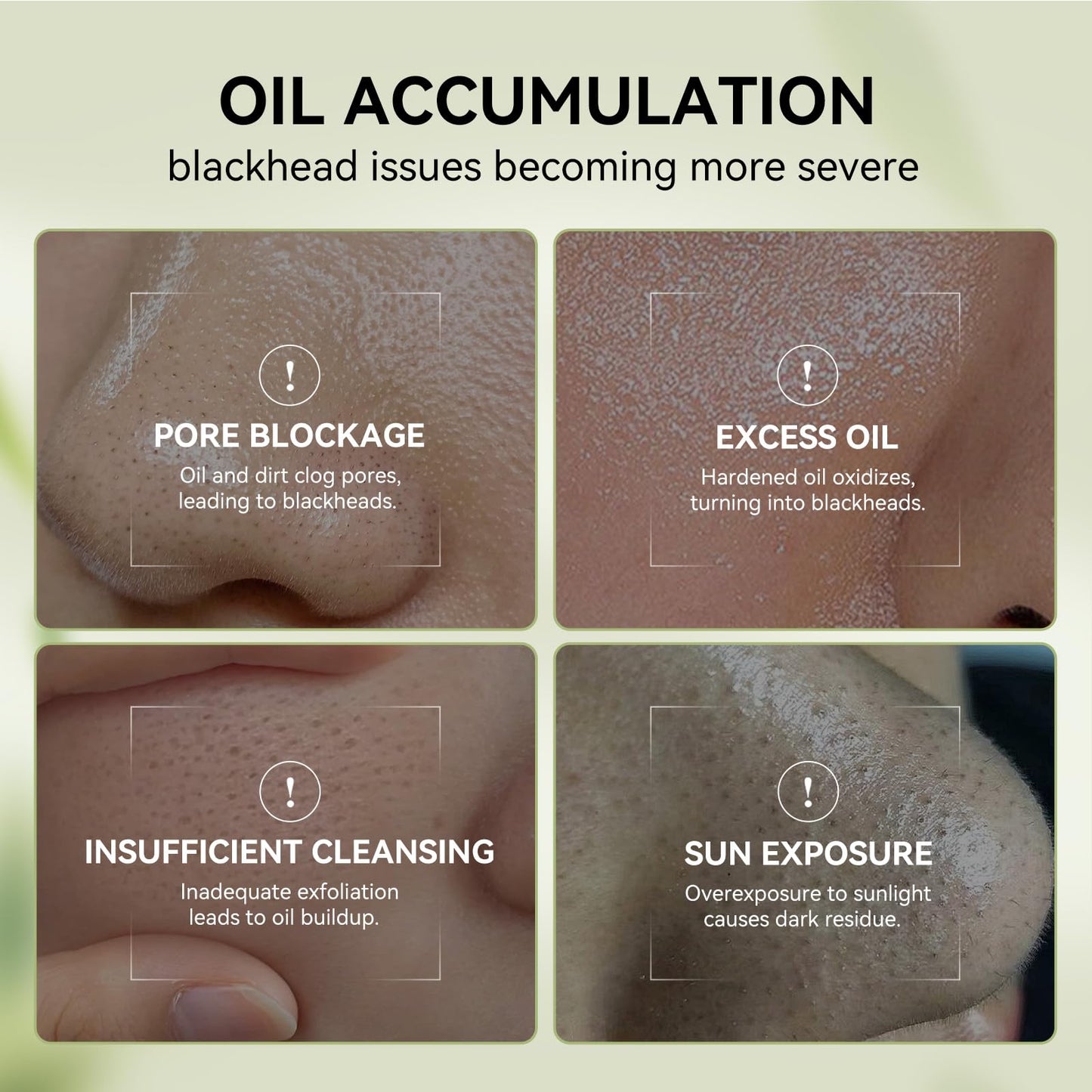 LANBENA 3-in-1 Blackhead Removal Set - Bamboo Charcoal Pore Strips (30g), Pore Minimizing Serum (30ml) & Removal Paper - Mask for Face, Minimizes Pores & Leaves Skin Fresh & Clean, Blackhead Remover