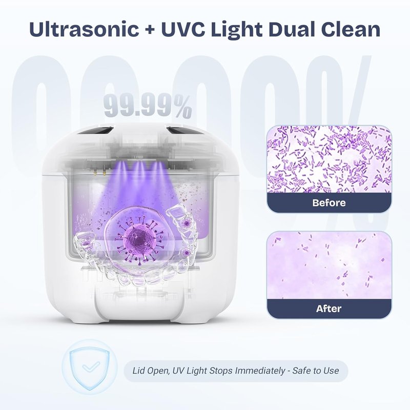 Ultrasonic Retainer Cleaner - 45KHz Portable Denture Cleaner with Drying Function | Ideal for Aligners, Jewelry & More