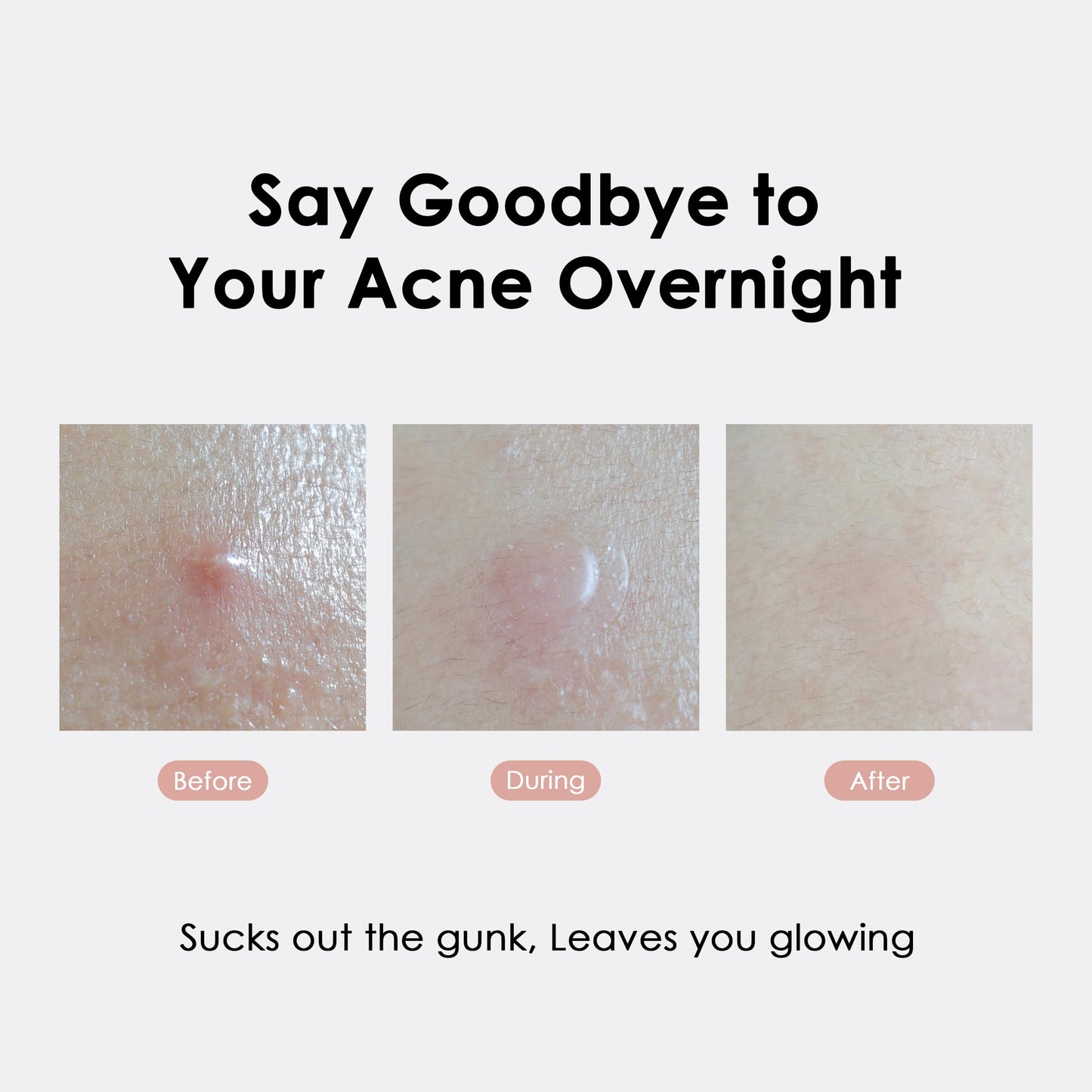 glowiest ASAP Active Spot Alleviating Patch 39 Patches [Daytime] 10mm (1 * 15ea) & 12mm (2 * 12ea) | Premium Hydrocolloid Dressing | Simple & Easy Active Treatment (Pack of 2)