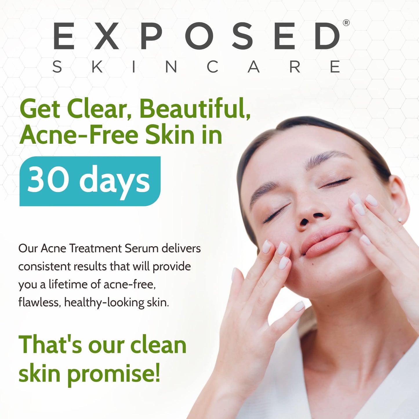 Exposed Skin Care, Acne Treatment Serum with 3.5% Benzoyl Peroxide – Lightweight Acne Spot Treatment – Quickly Clear Teen, Adult, Hormonal and Cystic Acne – Natural, Non-toxic and Cruelty Free