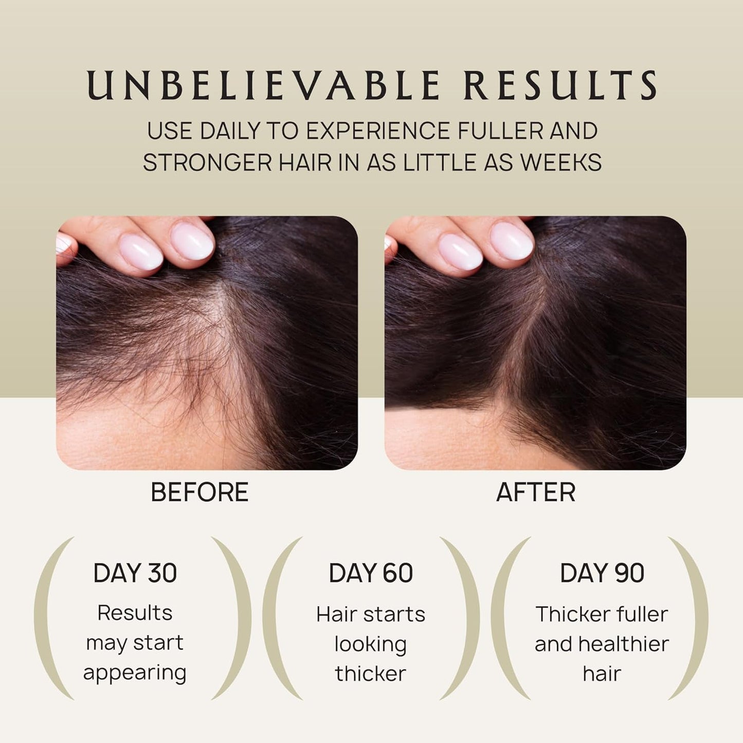 Hair Growth Oil Spray - 100% Pure Organic Batana, Castor & Rosemary Oils for Thicker Hair | 4.1 Fl Oz