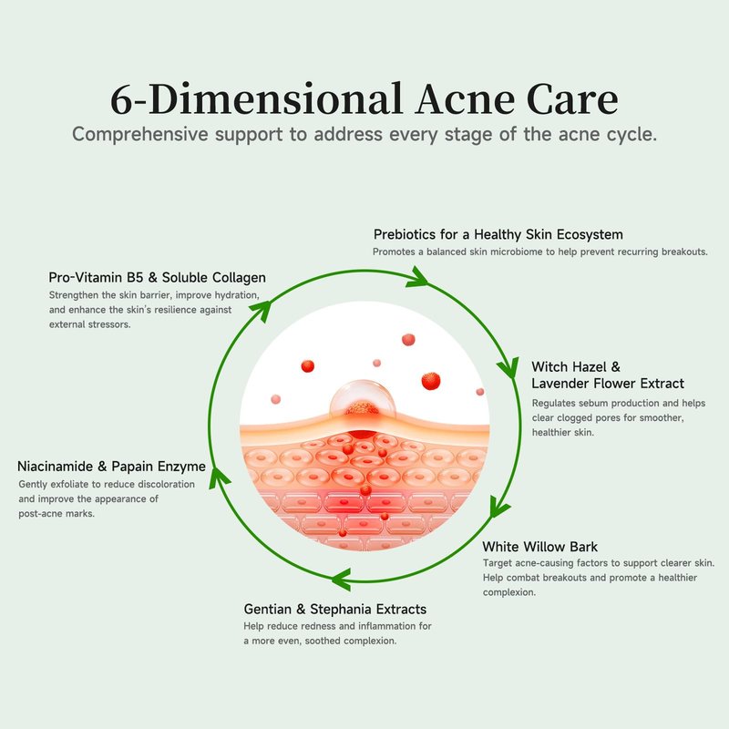 Gentle Botanical Acne Treatment for Face – Acid-Free Spot Facial Serum with Niacinamide & Witch Hazel, Soothes Redness & Controls Breakouts for Sensitive, Oily & Acne-Prone Skin – 1.2 ml × 30 Ampoules