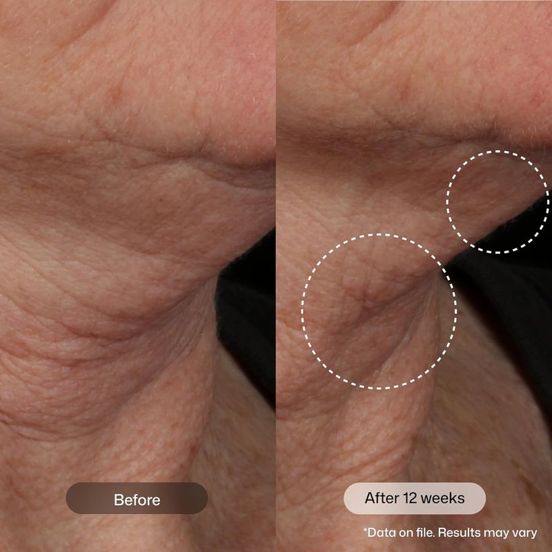 Revision Skincare Nectifirm Advanced® Neck Cream - Firming & Lifting Treatment for Neck, Jawline & Décolletage | Anti-Aging Solution