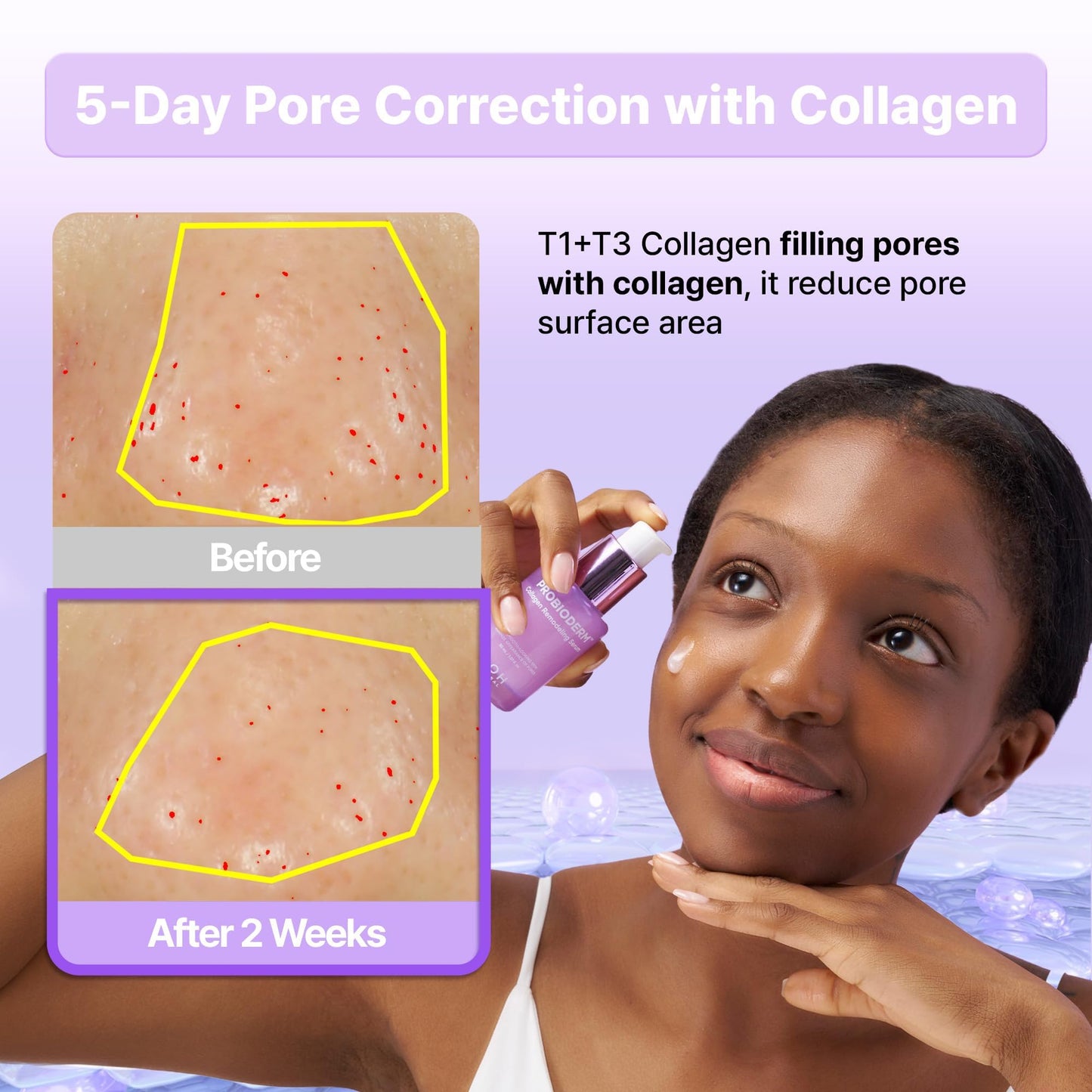 BIOHEAL BOH Probioderm™ Collagen Remodeling Serum 1.01 fl oz (30 ml) | Skin Firming Serum with Collagen & 12 Peptides for Pore Tightening & Smoothing | Hydrating & Lifting for Daily Skincare