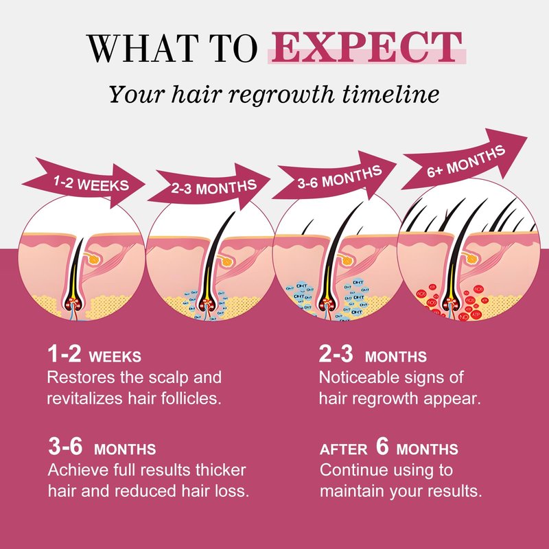 5% Minoxidil for Women Hair Regrowth Spray, hers hair regrowth treatment Infused with Biotin, Extra Strength Treatment to Combat Hair Loss and Thinning, 3 Bottles