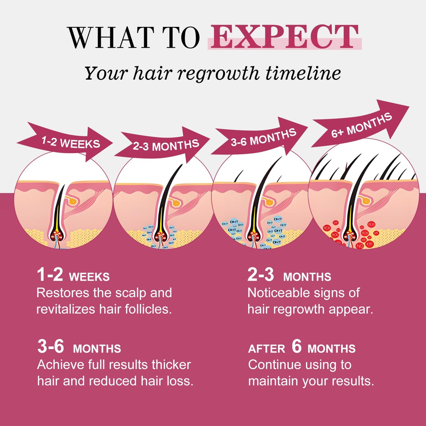 5% Minoxidil for Women Hair Regrowth Spray, hers hair regrowth treatment Infused with Biotin, Extra Strength Treatment to Combat Hair Loss and Thinning, 6 Bottles（100 Ml)