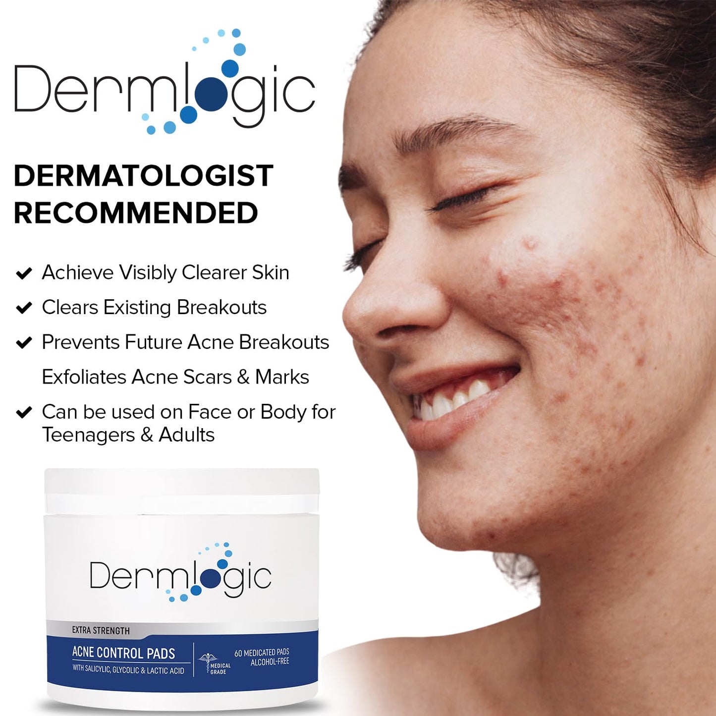Dermlogic Acne Treatment Pads - Glycolic, Lactic & Salicylic Acid for Oily Skin | Clears Clogged Pores & Breakouts