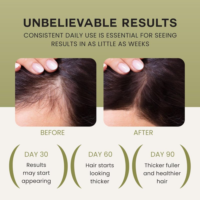 Lebanta Batana Oil for Hair Growth - 100% Pure Natural Blend with Organic Castor, Pumpkin Seed & Coconut Oil | Thicker, Stronger Hair (1 Pack)