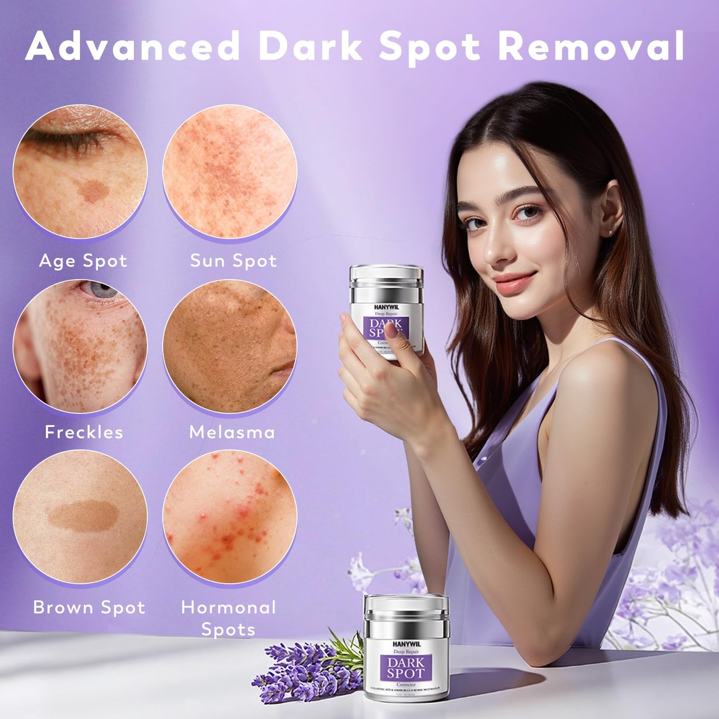HANYWIL Dark Spot Remover for Face & Body, Remedy for Dark Spots with Natural Ingredients, Dark Spot Corrector Cream and Serum for Skin Care, Treats Freckles, Melasma, Sun Spots, Women/Men,1.7 Fl Oz