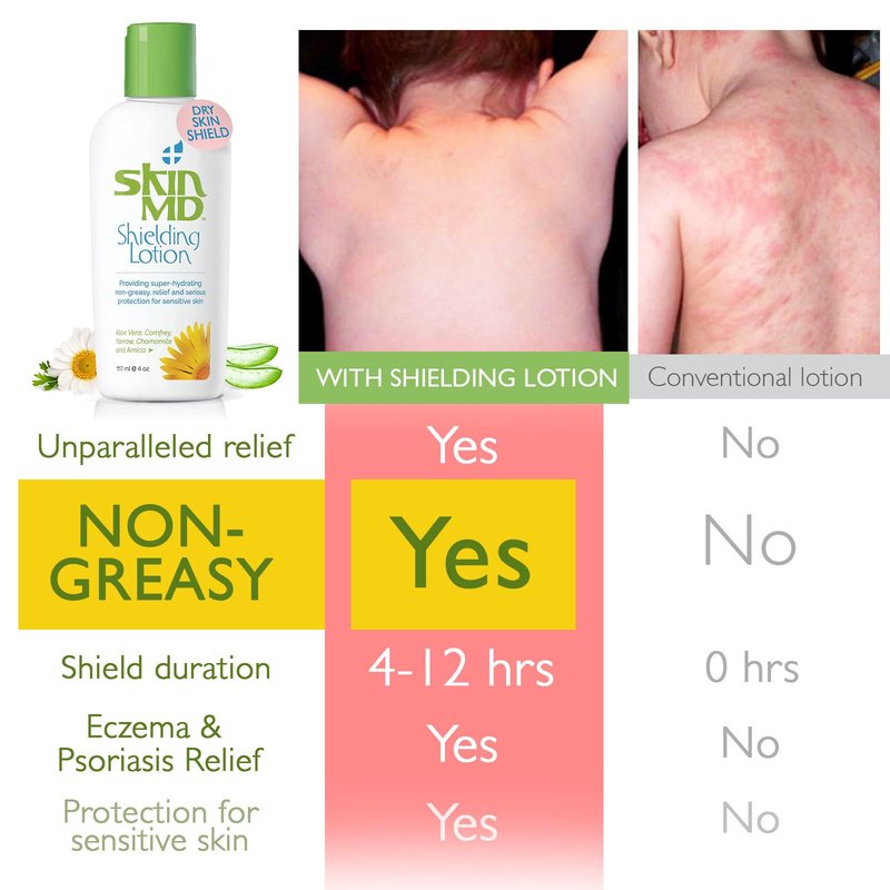Skin MD Shielding Lotion Hydrating Body Lotion for Sensitive Skin with Dispenser | Non-Greasy, Fast-Absorbing Moisturizer with Plant-Based Ingredients, Eczema & Psoriasis Relief - 8oz