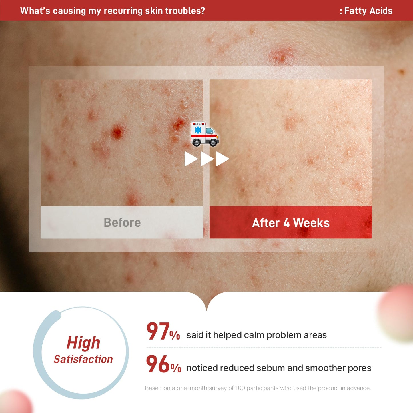 DERMAGENCY Zeroca 81 Cream | Korean Acne Cream for Sensitive & Oily Skin | Lightweight, Non-Greasy, Calming Hydration | Oil Control, Pore Refining, Cica | Fragrance-Free | K-beauty 2.02 Fl.Oz / 60ml