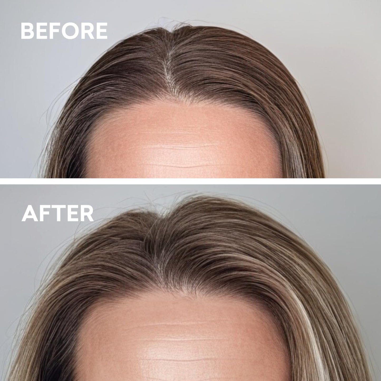 Volumizer Hair Tonic | Instant Volume and Lift | Lightweight Tonic For Men and Woman | Natural Hair Root Lifter for All Hair Types | Just Nutritive | 8 Fl Oz