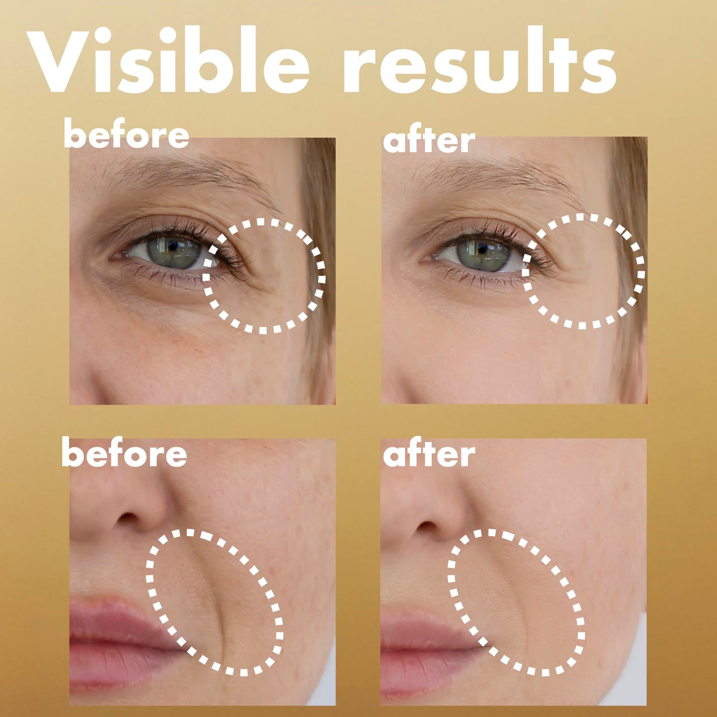 ISOI Intensive Energizing Cream EX, Deep Moisturizing Formula for Skin Elasticity, Face & Neck Cream for Tightening & Firming & Lifting, Korean Skin Care, (2.03 fl. oz, 60ml)