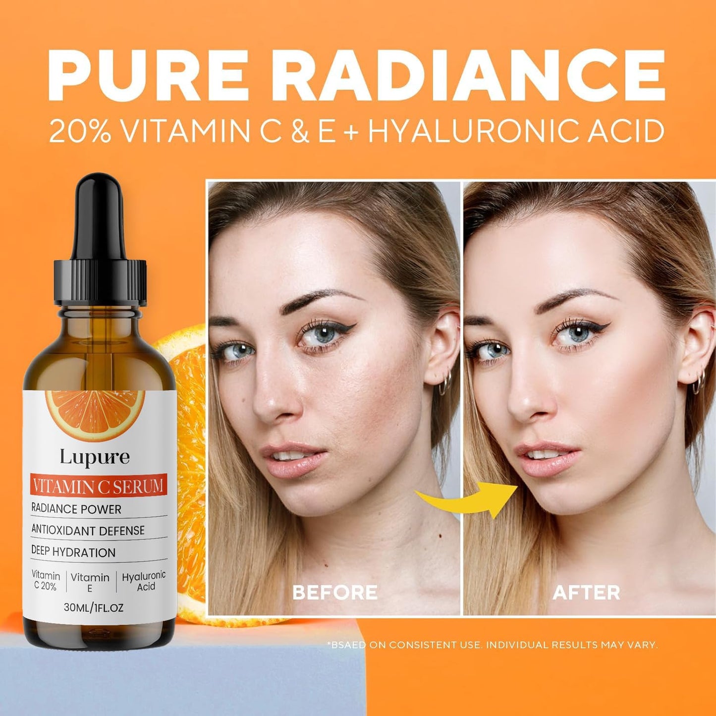 Lupure Vitamin C Face Serum 20% - Anti-Aging Formula with Hyaluronic Acid & Vitamin E | 1 Fl. Oz