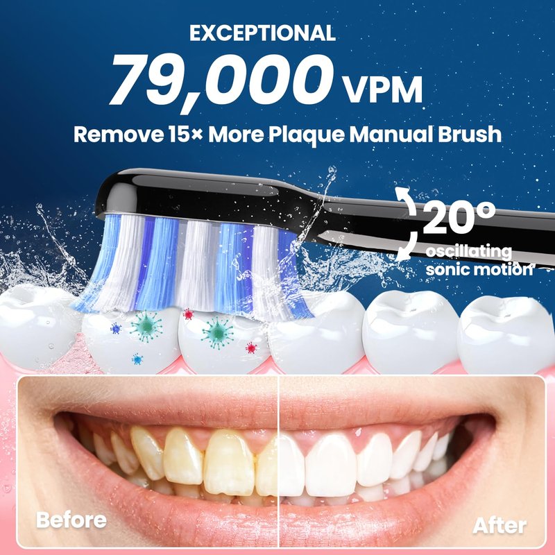 Marlincare Electric Toothbrush, Sonic Toothbrush for Adults Teens with Pressure Sensor, AI Zone Cleaning Tracking, 5 Modes & 3 Intensities, 180 Days Battery Life, 4 Brush Heads with Travel Case, Black