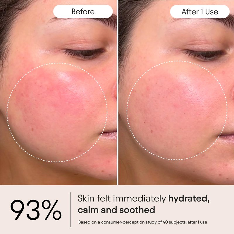 Alpyn Super Peptide & Ghostberry Moisturizer for Eczema, Wrinkle & Barrier Repair | Calm & Soothe Against Redness & Irritation (0.5 Oz)