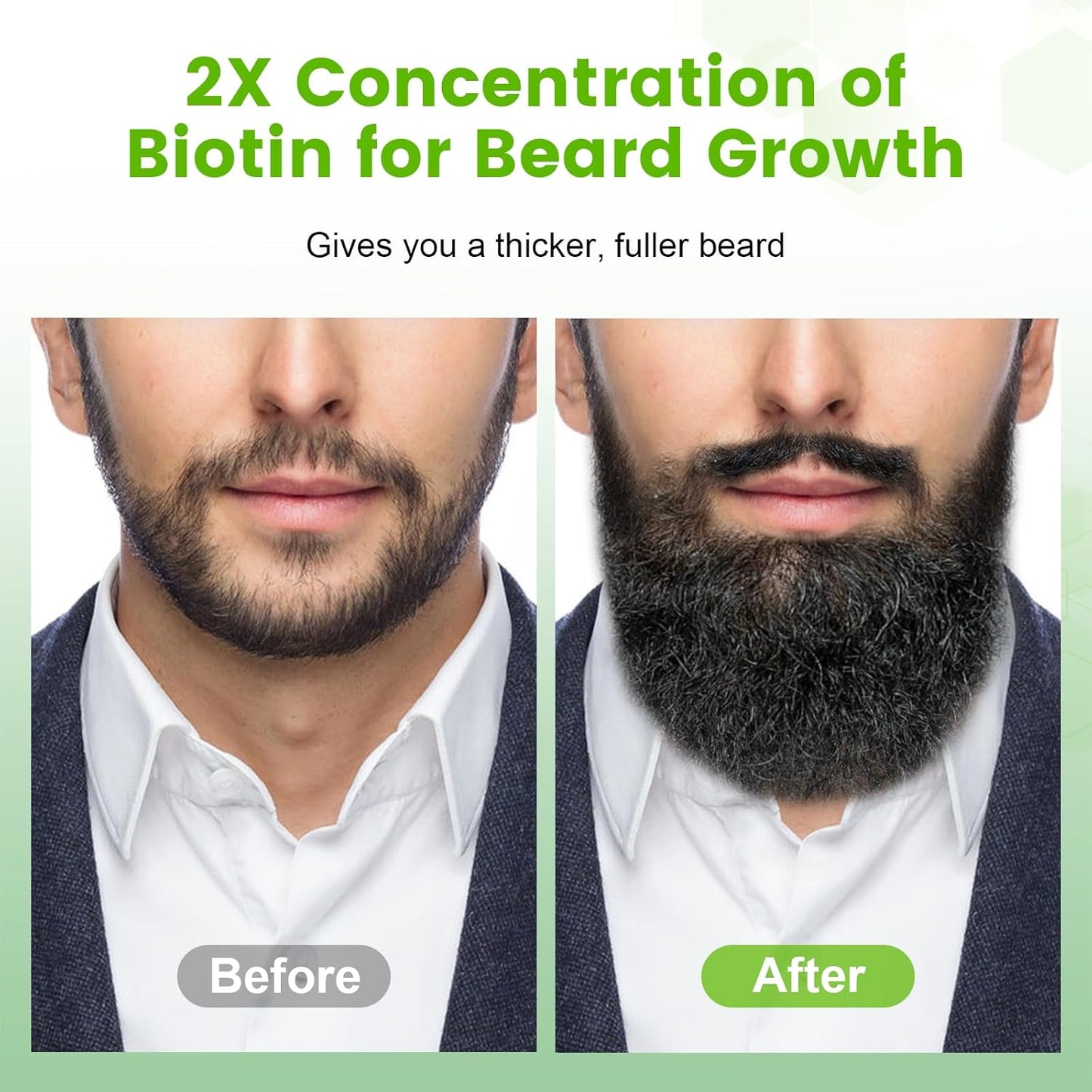 Beard Growth Balm | Nourishing Beard Growth Kit for Thicker, Fuller Beards