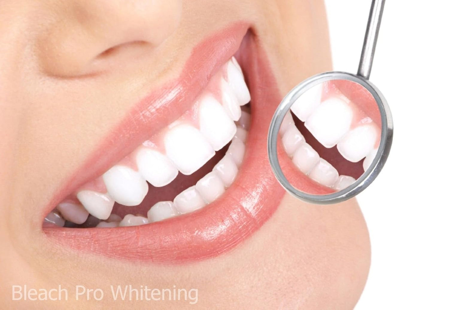 Teeth Whitening Gel Syringe Dispensers - 22% Carbamide Peroxide | 10 x 3ml Tooth Bleaching Gel Syringes