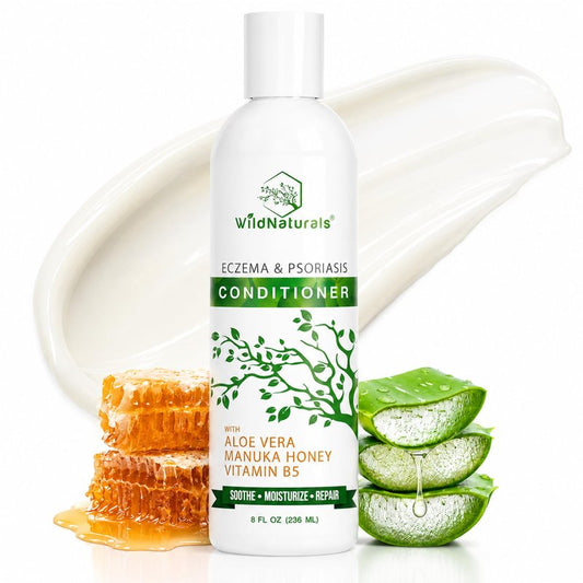 Natural Hydrating Conditioner for Dry & Itchy Scalp - Sulfate Free Dandruff Moisturizing Conditioner with Aloe Vera & Manuka Honey - for Oily Hair & Curly hair - Help Hair Growth with Coconut Oil