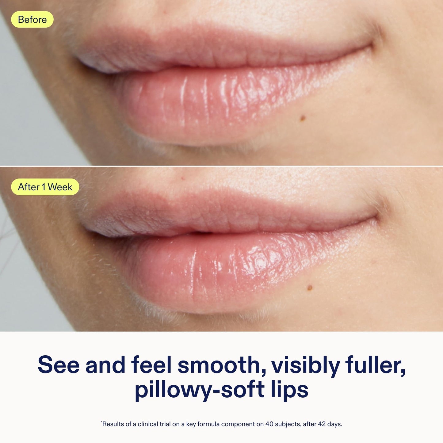 Skinfix Triple Lipid Lip Treatment - 0.27 oz - Hydrating, Volumizing Balm - Visibly Smooths Fine Lines - Fragrance Free - Vegan, Cruelty Free