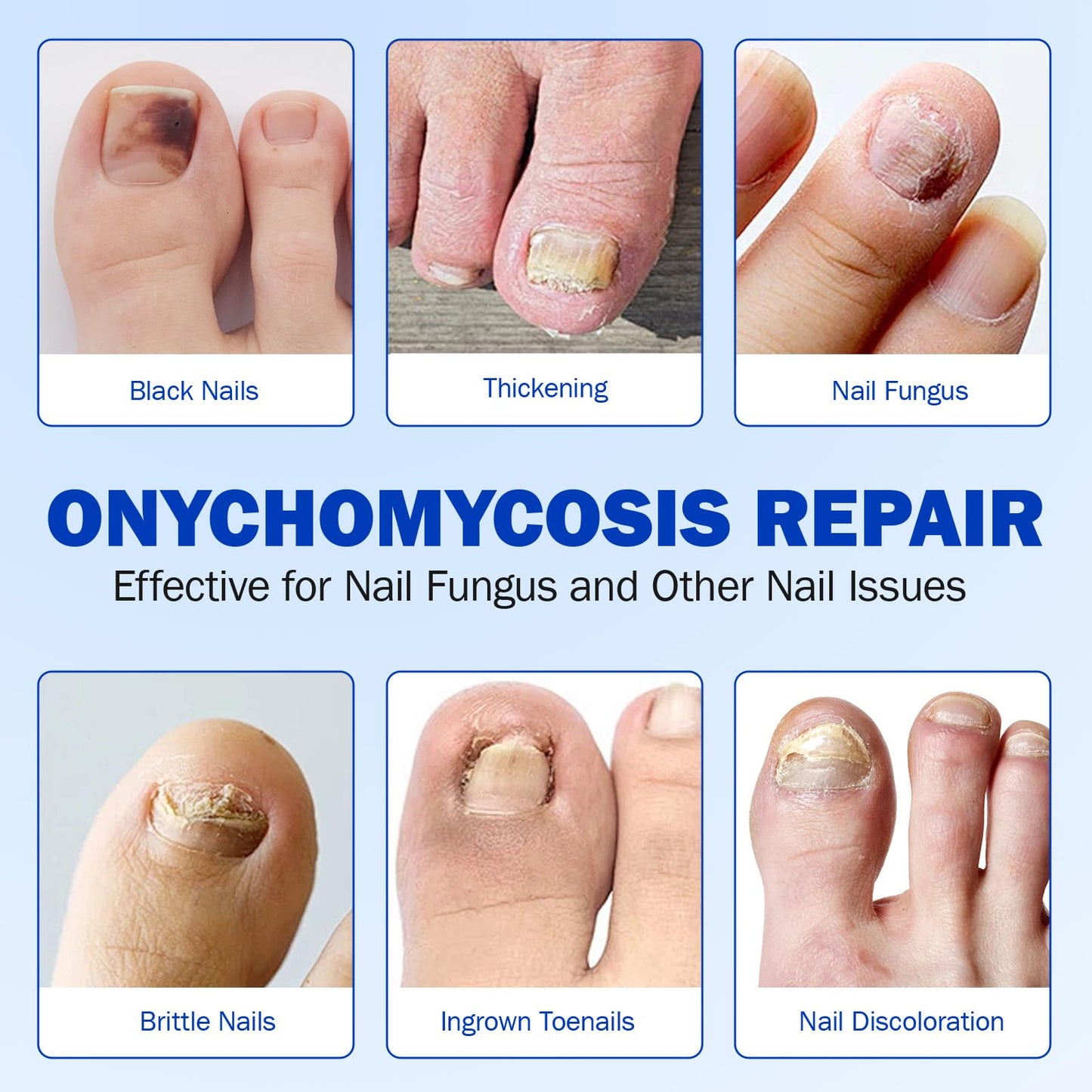Toenail Treatment Extra Strength, Nail Repair Patches, 8 Hours Overnight Renewal for Thick, Brittle and Discolored Toe Nail, Repair & Strengthen Damaged Foot Nails, 2 Pack (42 Pcs)